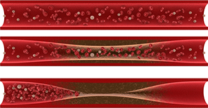 液の循環をよくします